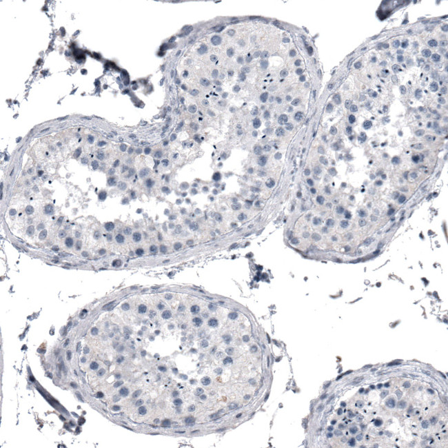 KRT77 Antibody in Immunohistochemistry (IHC)