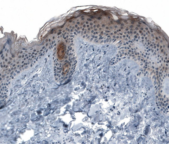 KRT77 Antibody in Immunohistochemistry (IHC)