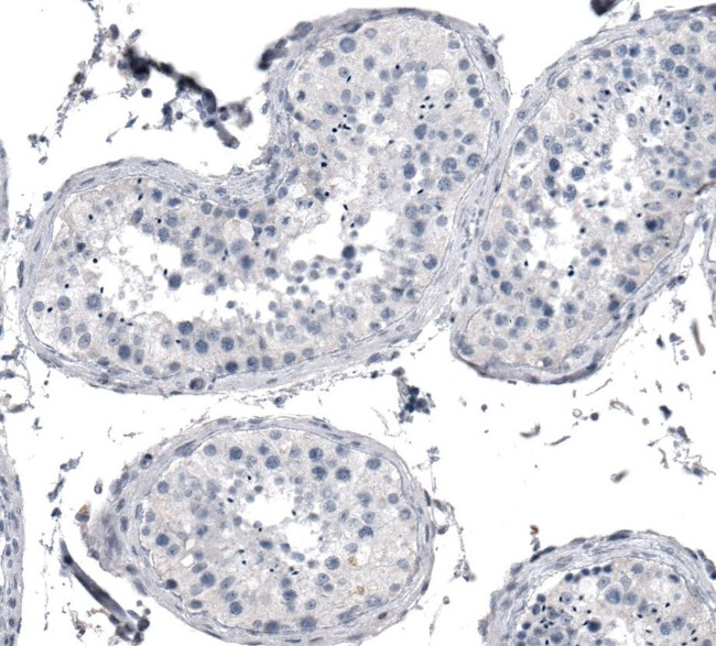 KRT77 Antibody in Immunohistochemistry (IHC)