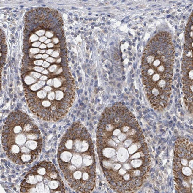 COQ10B Antibody in Immunohistochemistry (Paraffin) (IHC (P))