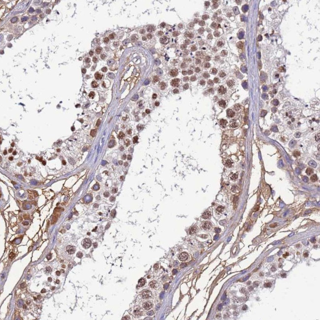 H1FNT Antibody in Immunohistochemistry (Paraffin) (IHC (P))