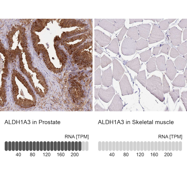 ALDH1A3 Antibody