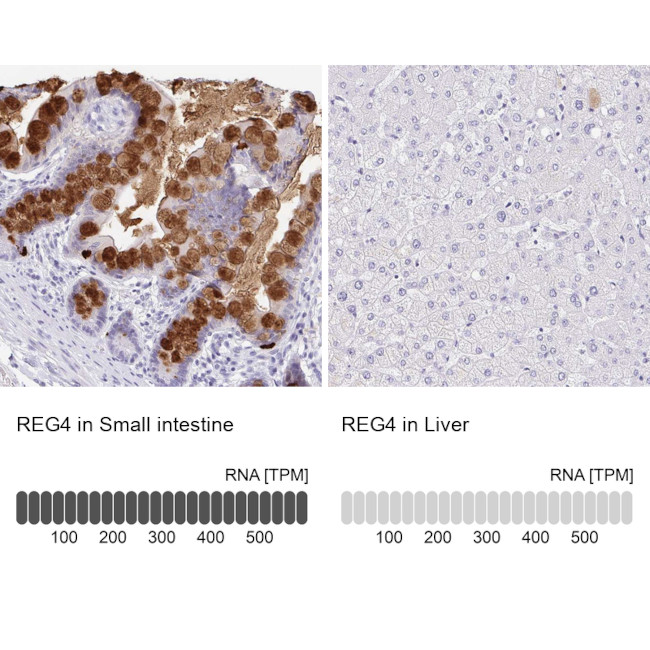 REG4 Antibody in Immunohistochemistry (IHC)