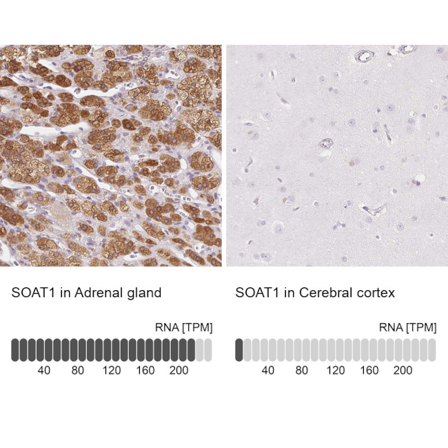 SOAT1 Antibody in Immunohistochemistry (IHC)