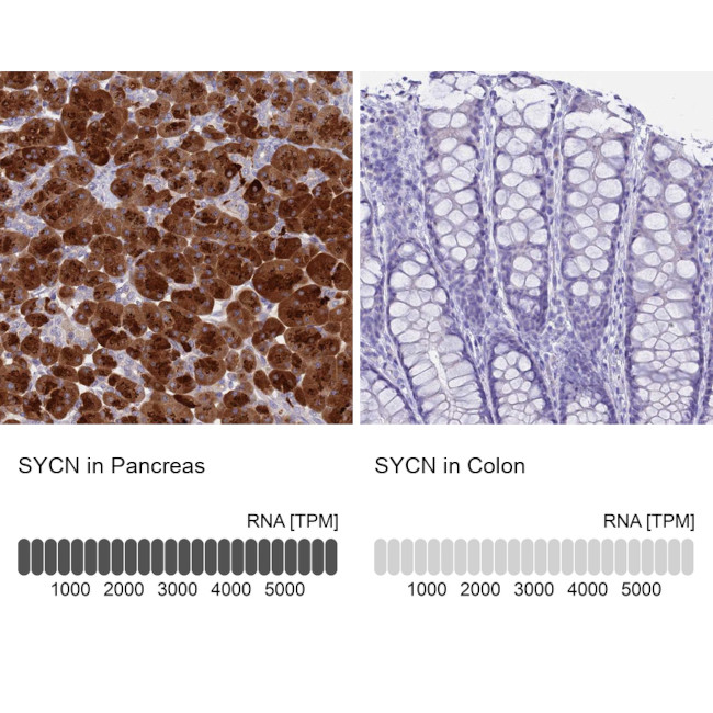 Syncollin Antibody in Immunohistochemistry (IHC)