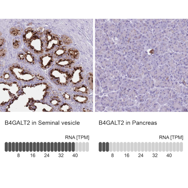 B4GALT2 Antibody in Immunohistochemistry (IHC)