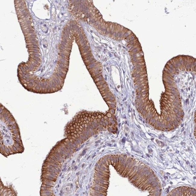 SLC15A3 Antibody in Immunohistochemistry (IHC)