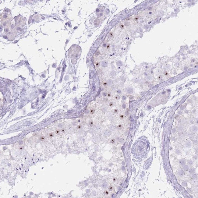 PNMA3 Antibody in Immunohistochemistry (IHC)