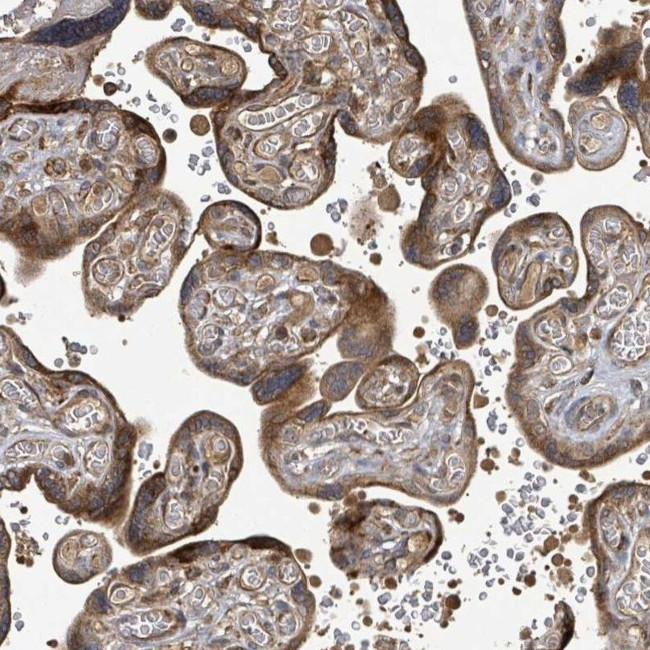 STARD4 Antibody in Immunohistochemistry (IHC)