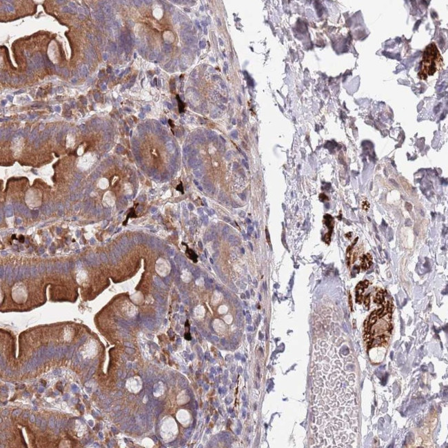 NLRP6 Antibody in Immunohistochemistry (Paraffin) (IHC (P))