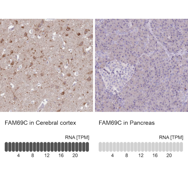 FAM69C Antibody in Immunohistochemistry (IHC)