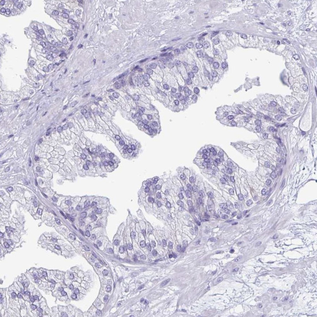 TFPI2 Antibody in Immunohistochemistry (IHC)