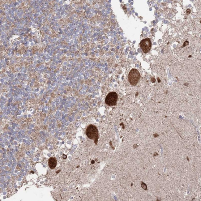 BTBD18 Antibody in Immunohistochemistry (Paraffin) (IHC (P))