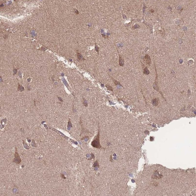 ATXN10 Antibody in Immunohistochemistry (IHC)