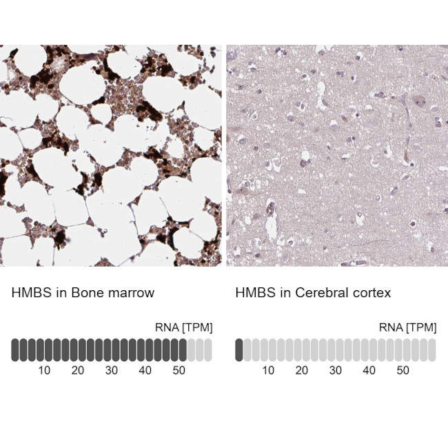 HMBS Antibody in Immunohistochemistry (IHC)