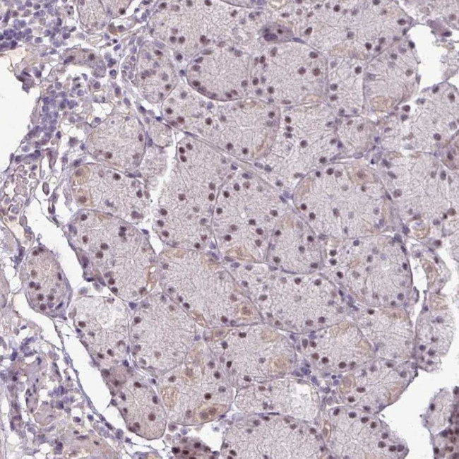 KIAA1530 Antibody in Immunohistochemistry (Paraffin) (IHC (P))