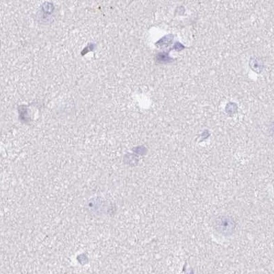 SPESP1 Antibody in Immunohistochemistry (IHC)