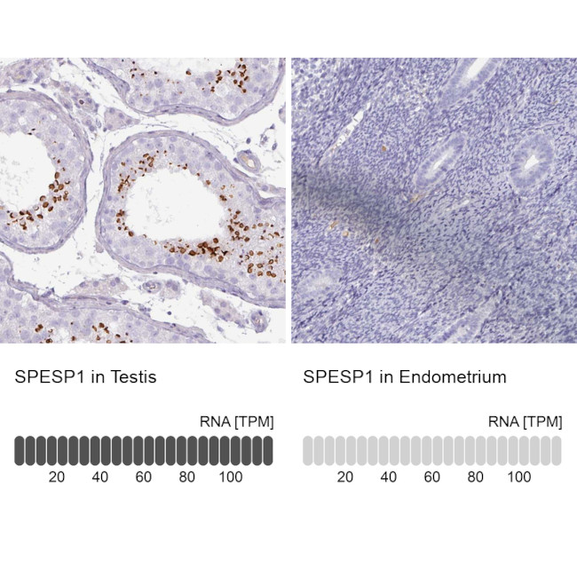 SPESP1 Antibody