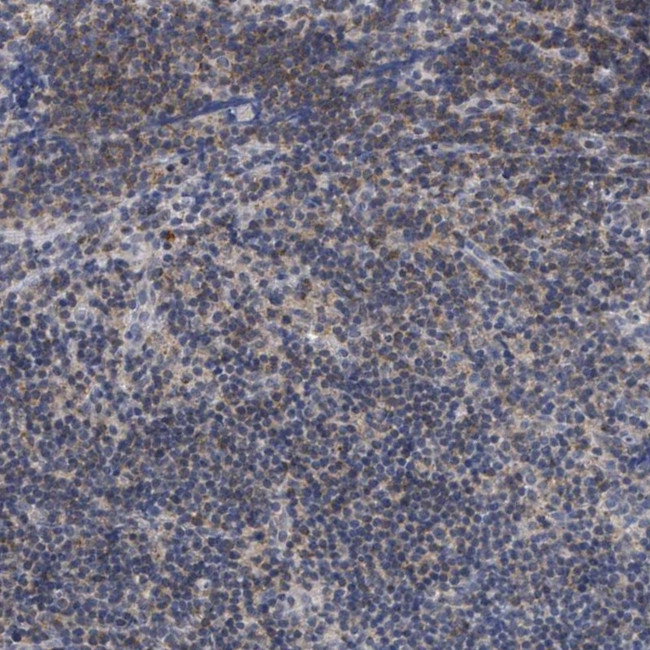 ANKRD55 Antibody in Immunohistochemistry (Paraffin) (IHC (P))