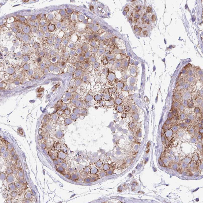 FAM105B Antibody in Immunohistochemistry (Paraffin) (IHC (P))