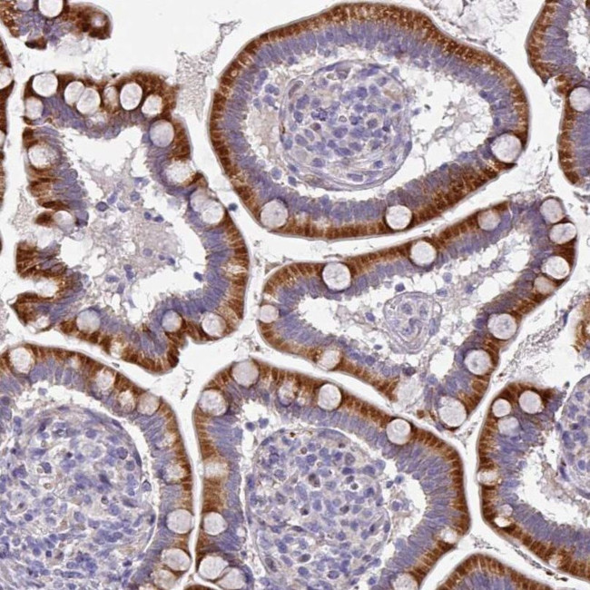 KLHL3 Antibody in Immunohistochemistry (IHC)