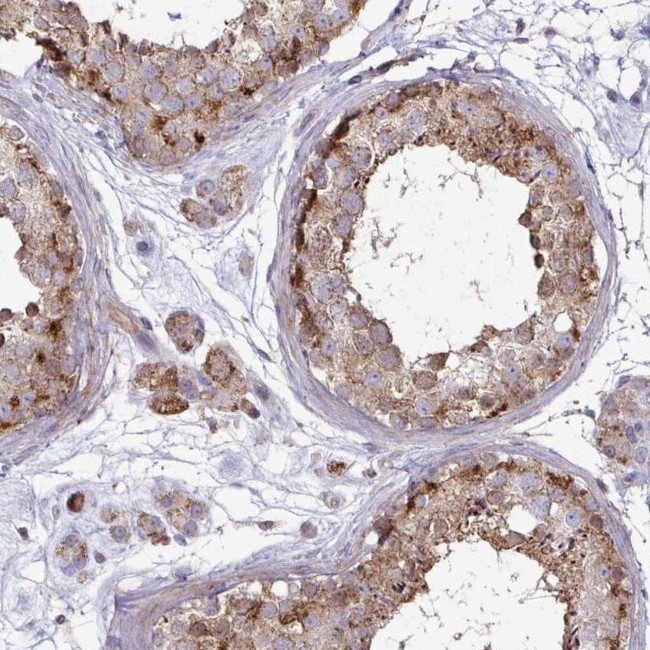 SPRY1 Antibody in Immunohistochemistry (IHC)