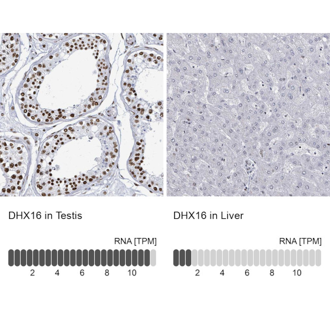 DHX16 Antibody in Immunohistochemistry (IHC)