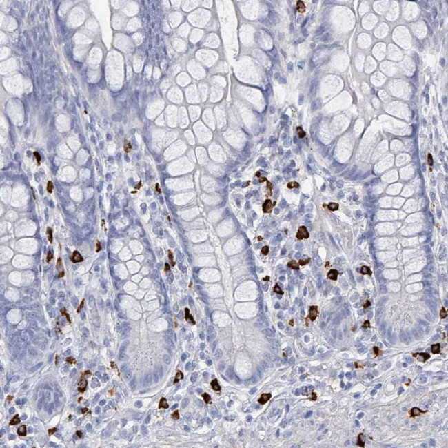 VPS13D Antibody in Immunohistochemistry (IHC)