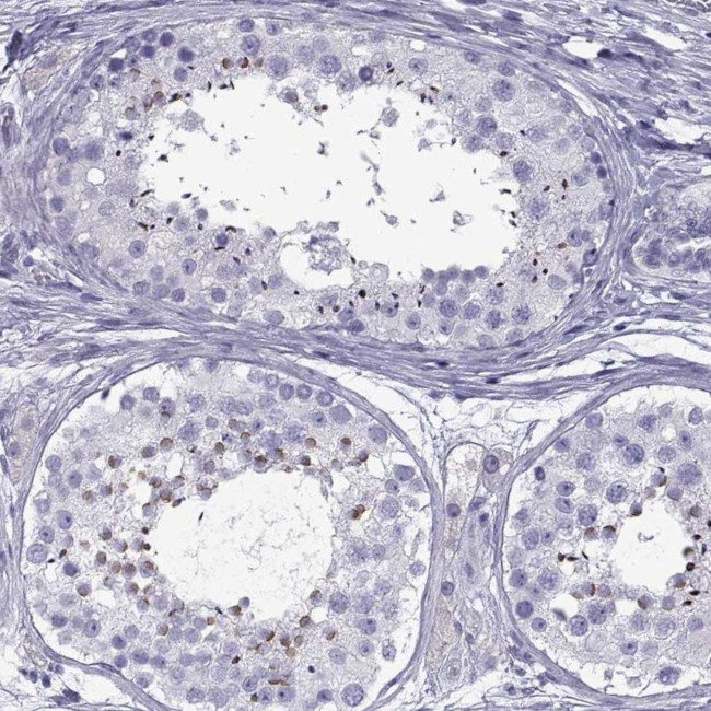 SPDYE1 Antibody in Immunohistochemistry (IHC)