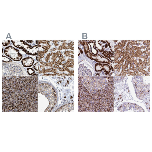 SUCLG2 Antibody in Immunohistochemistry (IHC)