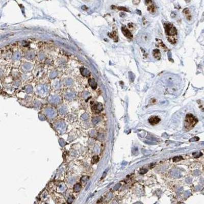 SUCLG2 Antibody in Immunohistochemistry (IHC)