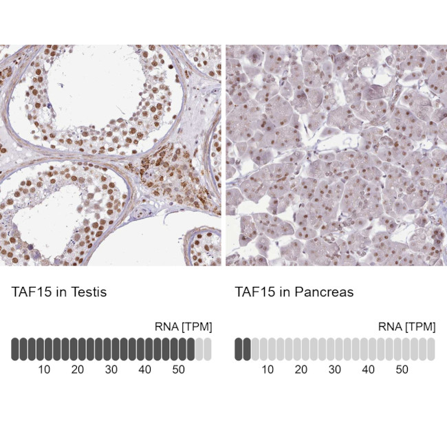 TAF15 Antibody in Immunohistochemistry (IHC)