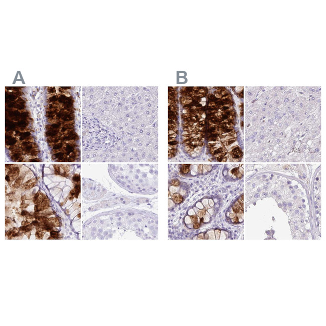 ZG16 Antibody in Immunohistochemistry (IHC)