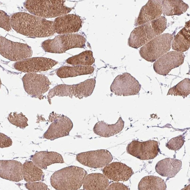 KBTBD5 Antibody in Immunohistochemistry (IHC)