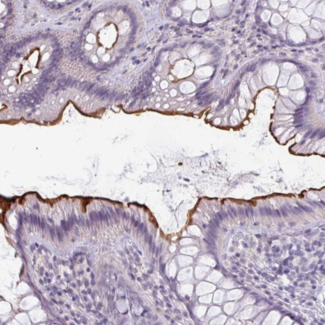 EYA3 Antibody in Immunohistochemistry (Paraffin) (IHC (P))