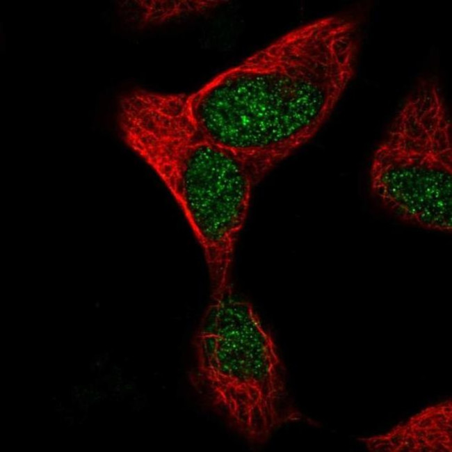 TTC30A Antibody in Immunocytochemistry (ICC/IF)