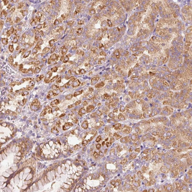 MAP10 Antibody in Immunohistochemistry (Paraffin) (IHC (P))