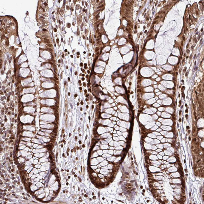 COPRS Antibody in Immunohistochemistry (IHC)