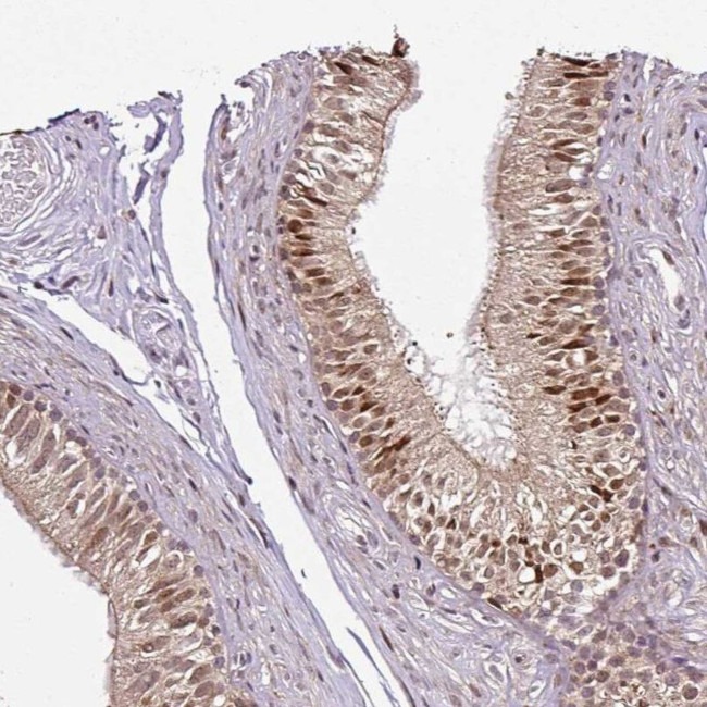 COPRS Antibody in Immunohistochemistry (IHC)