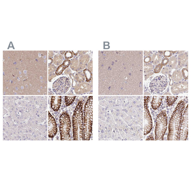 Nhe-1 Antibody in Immunohistochemistry (IHC)