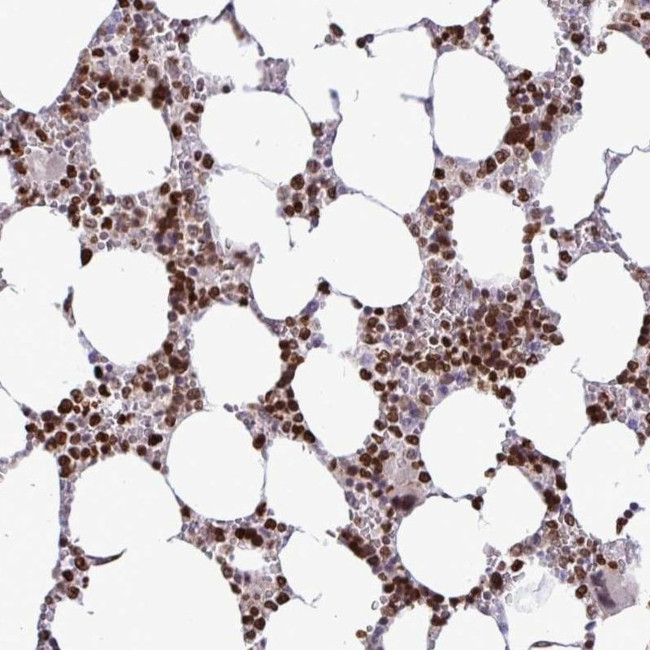 HMGB2 Antibody in Immunohistochemistry (IHC)