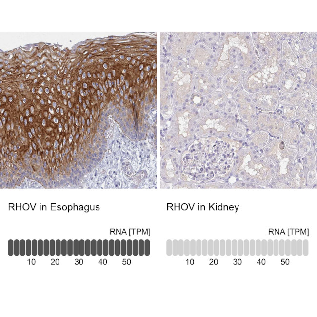 RhoV Antibody in Immunohistochemistry (IHC)