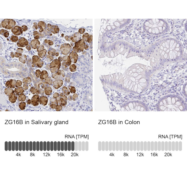 ZG16B Antibody in Immunohistochemistry (IHC)