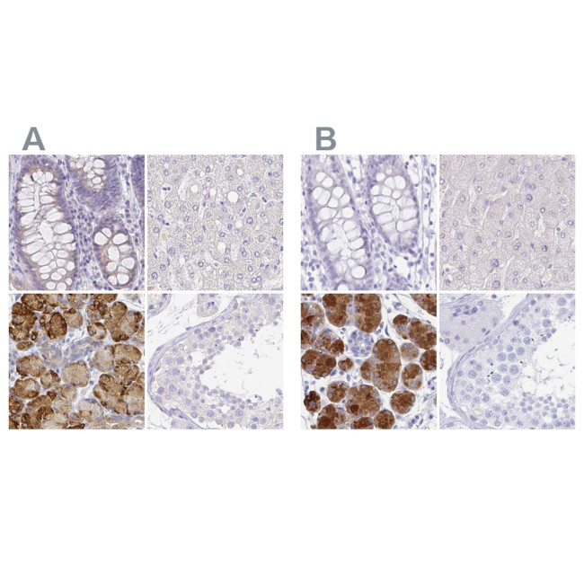 ZG16B Antibody in Immunohistochemistry (IHC)