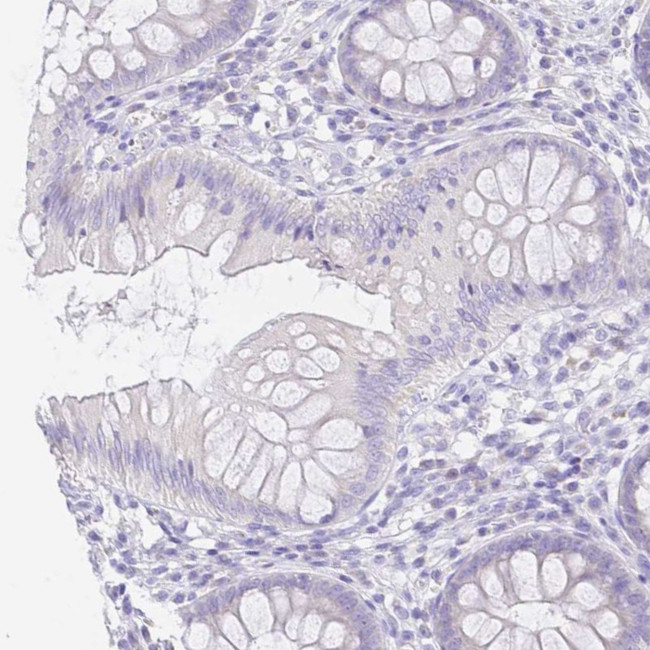 ZG16B Antibody in Immunohistochemistry (IHC)