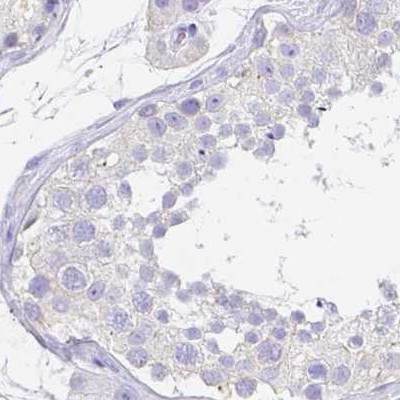 ZG16B Antibody in Immunohistochemistry (IHC)