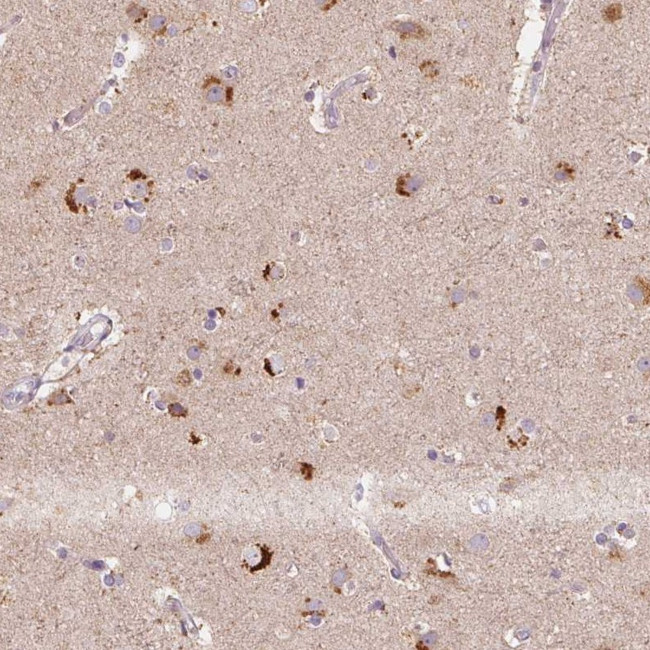 METTL13 Antibody in Immunohistochemistry (Paraffin) (IHC (P))