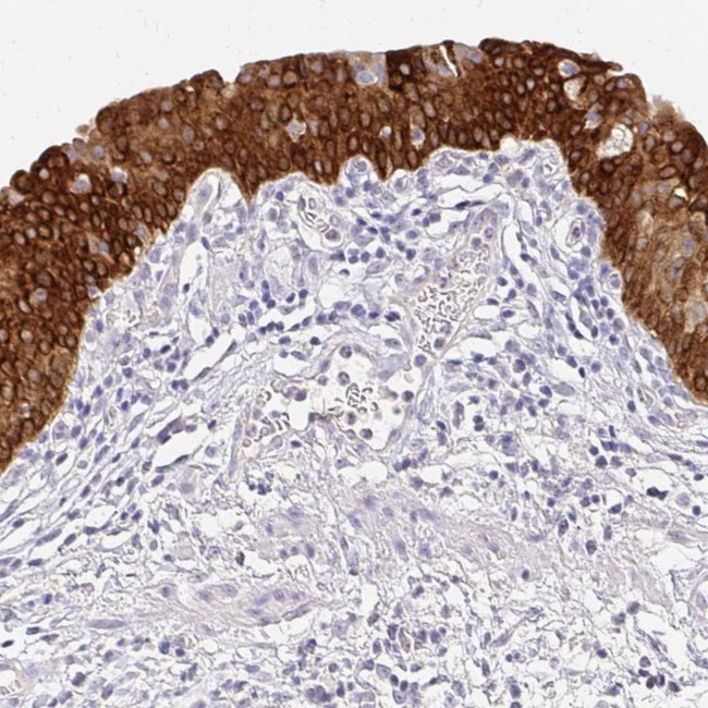 UGT1A6 Antibody in Immunohistochemistry (IHC)