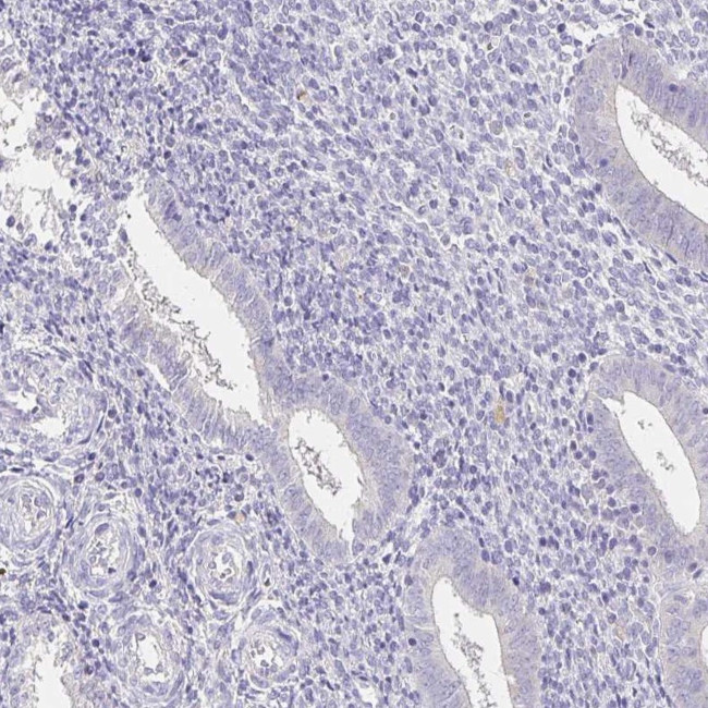 UGT1A6 Antibody in Immunohistochemistry (IHC)