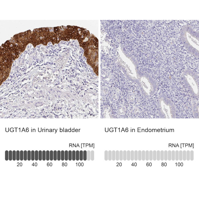 UGT1A6 Antibody